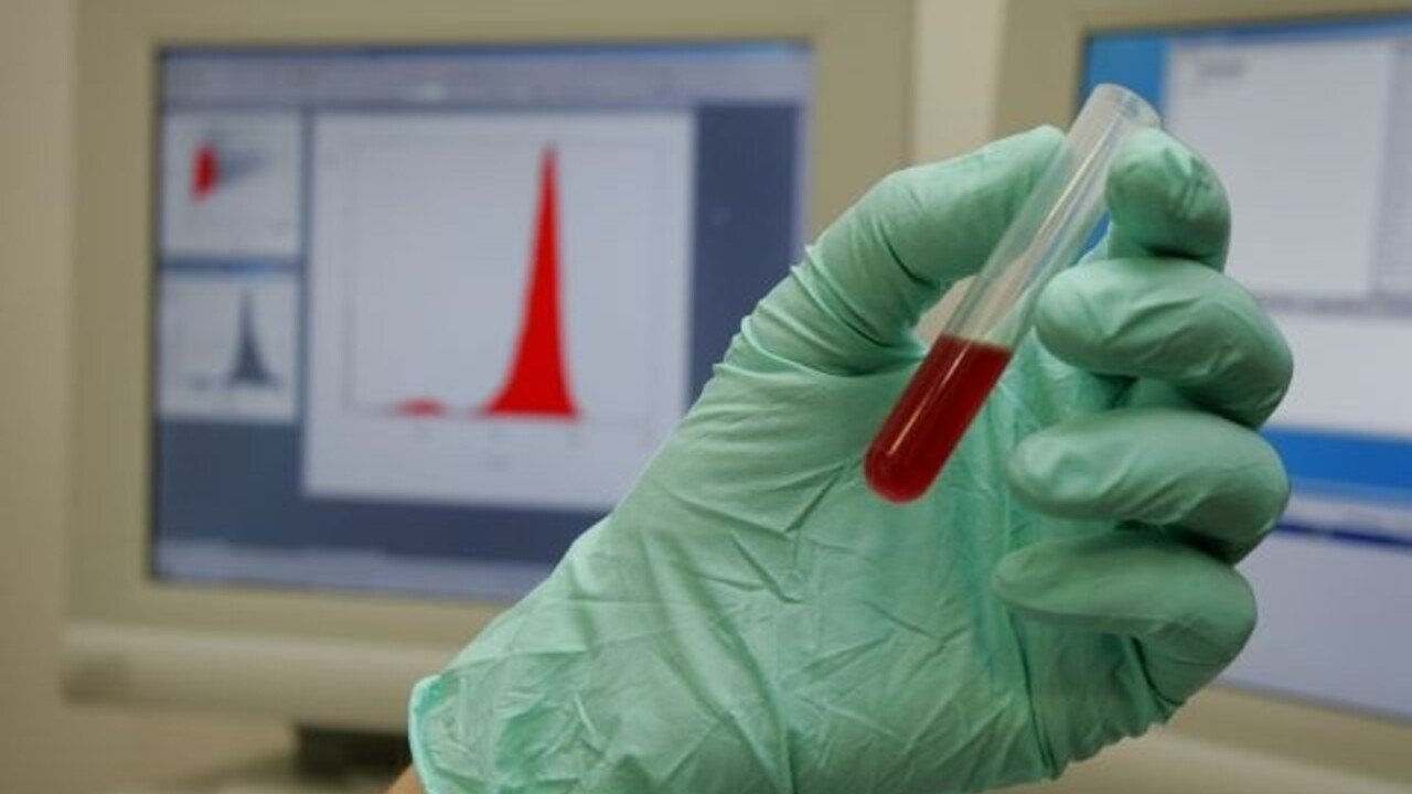 krv krvné testy odber lekár doktor pacient ilu (SITA)